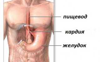 Сфинктер пищевода: как укрепить, симптомы, лечение