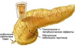 Алкоголь при панкреатите поджелудочной железы: какой алкоголь можно пить при панкреатите