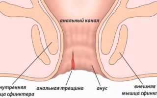 Мази при анальной трещине у ребенка, взрослых эффективные при ГВ, геморрое, беременности