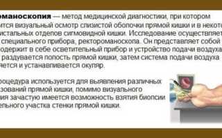 Альтернатива колоноскопии: методы обследования кишечника, их плюсы и минусы, советы медиков