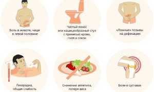 Ленивый кишечник: симптомы и лечение для взрослых и пожилых