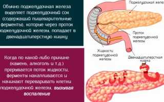 Первая помощь при панкреатите: тактика фельдшера при острой форме панкреонекроза
