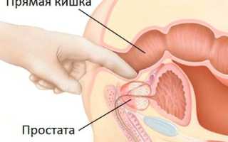 Не все виды массажа полезны при геморрое — сделай правильный выбор!