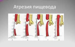 Расшифровка УЗИ желудка у плода на втором скрининге