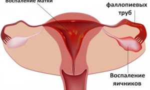 Почему после еды болит живот? 7 возможных причин