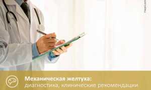Как лечить желтуху после удаления желчного пузыря?