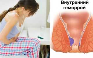 Почему перед месячными обостряется геморрой и как быстро вылечить его