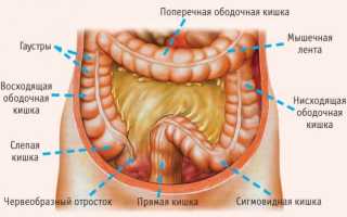 Рак ободочной кишки — классификация, первые симптомы, диагностика и лечение