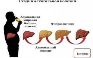 Боль в печени с похмелья: что делать и как лечить тяжелые симптомы, первая помощь