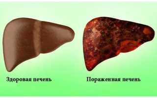 Основные симптомы и виды гепатита у женщин. Фото больных с первыми признаками недуга