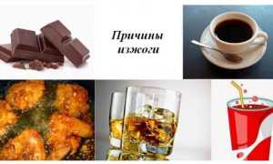 Причины и что делать при изжоге и тяжести в желудке