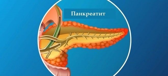 Чем опасен панкреатит и какие могут быть последствия?