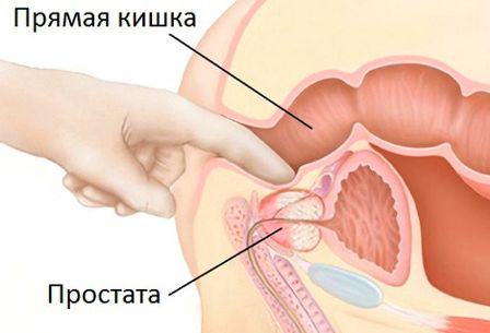 Фото: массаж при геморрое