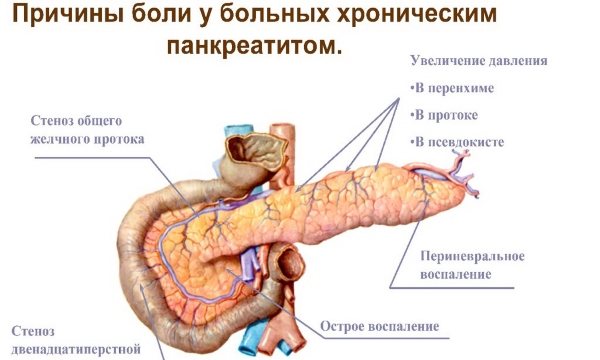 Повышенное давление в протоках поджелудочной приводит к застою пищеварительного сока, который со временем нарушает структуру органа.