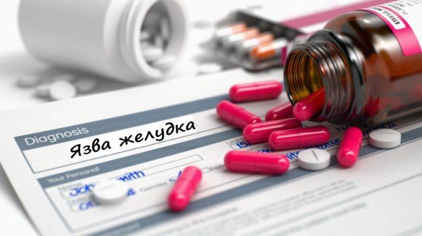 Противоязвенные лекарства