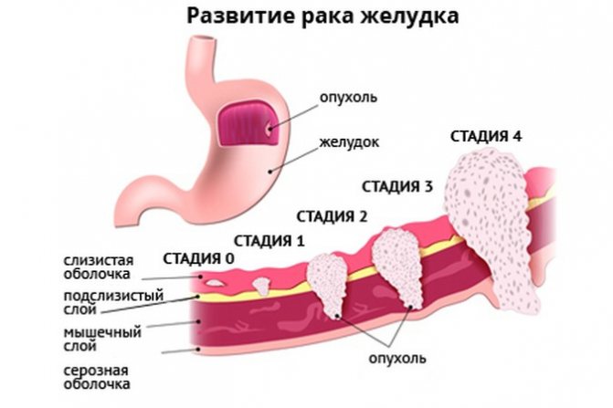 Стадии
